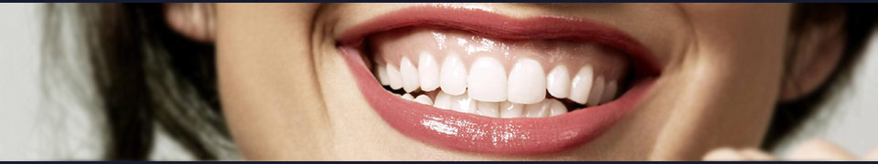 Pilt valgetest hammastest